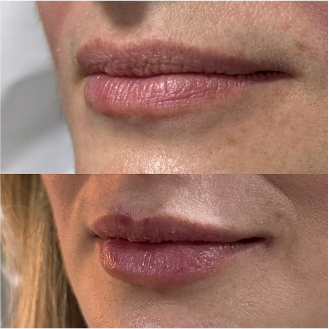 PHOTO-2025-06-30-08-45-52 1